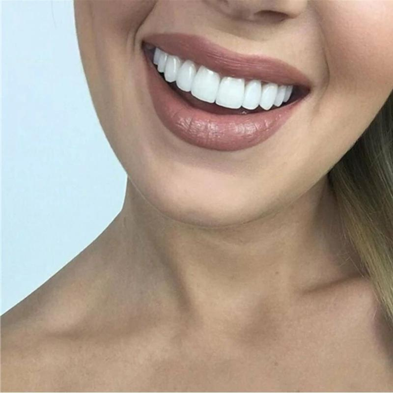 Chic and Style | PerfectSnap | Always the perfect smile