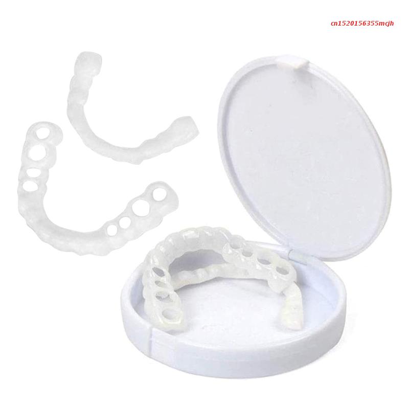 Chic and Style | SmileSnap - Always the perfect smile with these veneers