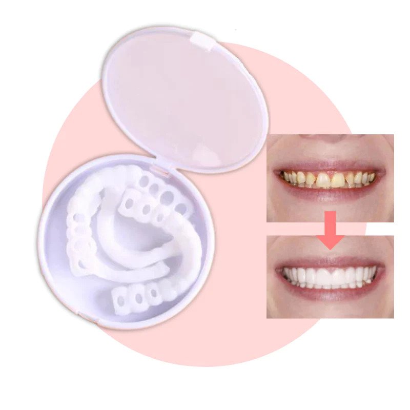 Chic and Style | SmileSnap - Always the perfect smile with these veneers