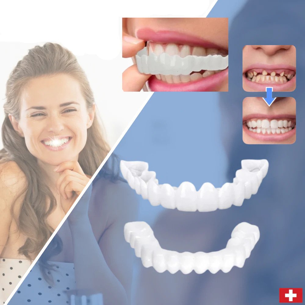 Chic and Style | SmileSnap - Always the perfect smile with these veneers