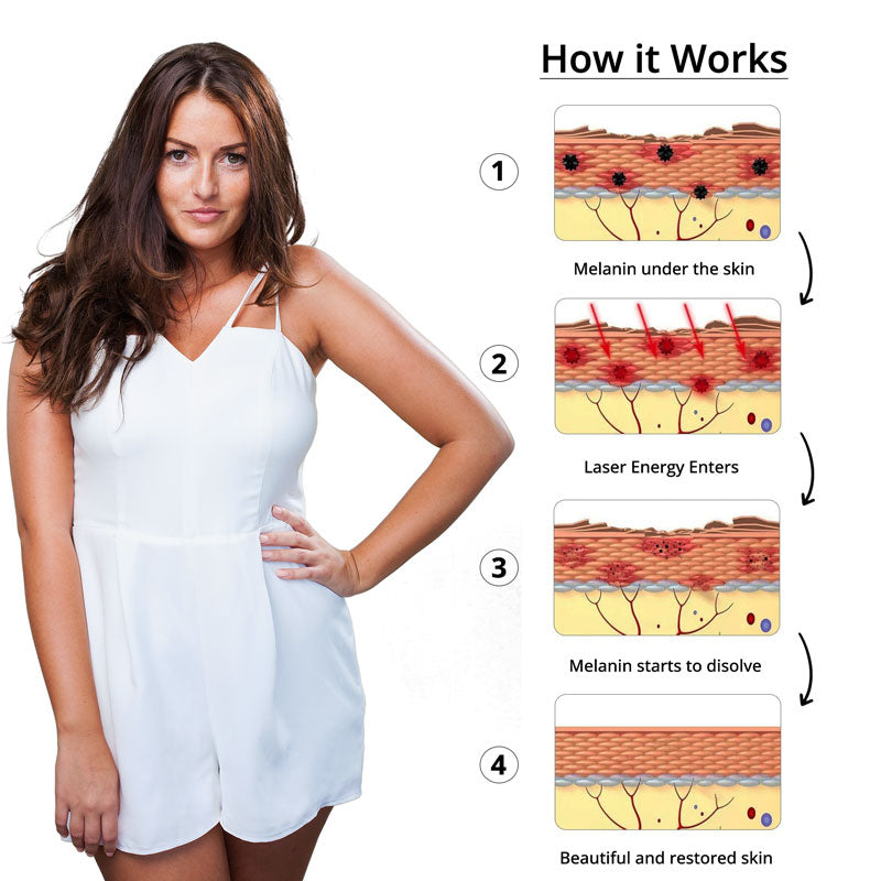 Chic and Style | Laser Tattoo Removal
