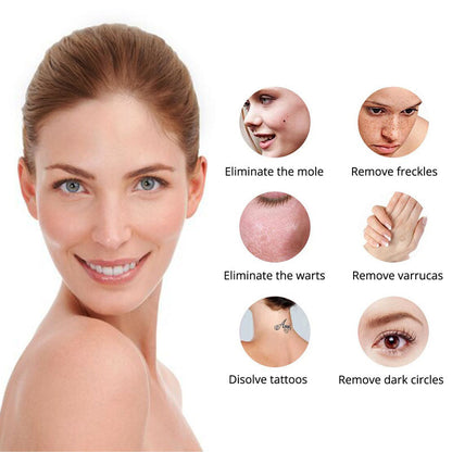 Chic and Style | Laser Tattoo Removal