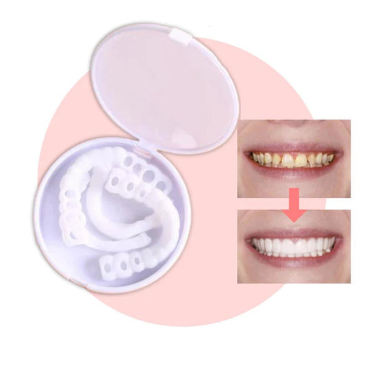 Chic and Style | SmileSnap - Always the perfect smile with these veneers