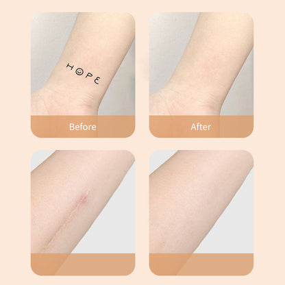 Chic and Style | New Products Ultra-Thin Tattoo and Scar Camouflage Patch