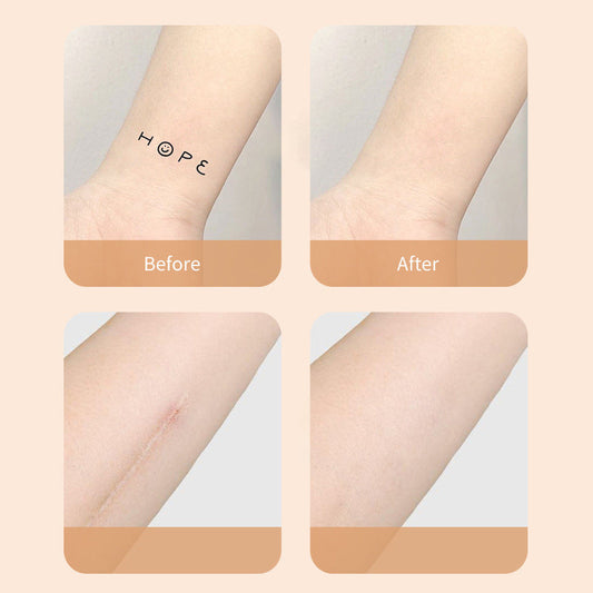 Chic and Style | New Products Ultra-Thin Tattoo and Scar Camouflage Patch